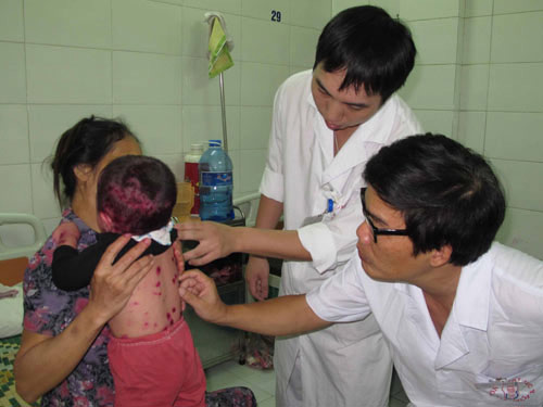 Hà Nội bắt đầu tiêm vắc xin thủy đậu - 1