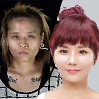 Sốc với ca biến “vịt cồ” siêu xấu thành hot girl