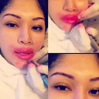 Sức khỏe đời sống - "Bảo dưỡng" sau đại phẫu thuật thẩm mỹ: Chuyên gia nói gì?