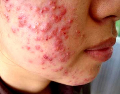 Rùng rợn trào lưu lột da như rắn để làm trắng - 2