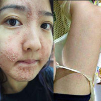 Bí quyết làm đẹp - Rùng rợn trào lưu lột da như rắn để làm trắng