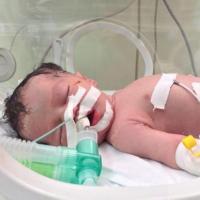 Tin tức trong ngày - Em bé thần kỳ sinh ra trong bom đạn Gaza qua đời