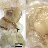 Sức khỏe đời sống - Kỹ thuật mới: Làm cơ thể trong suốt để chữa bệnh