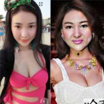 Thẩm mỹ viện - Gương mặt dao kéo hỏng của &quot;hot girl bán dâm&quot;