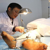 Phi thường - kỳ quặc - Người đàn ông có hai "bàn chân phải"