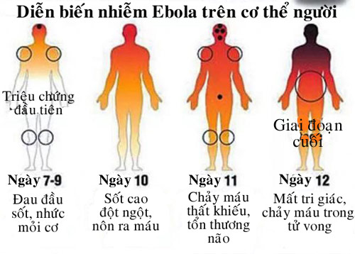 Liberia ban bố tình trạng khẩn cấp vì đại dịch Ebola - 2