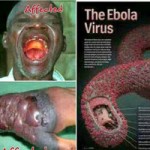 Tin tức trong ngày - Dịch Ebola tồi tệ nhất trong lịch sử: Lây qua tiếp xúc