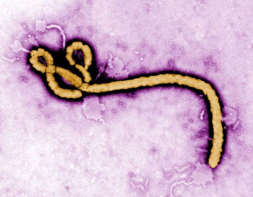 Ebola có lây qua đường tình dục? - 1