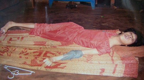 Nạn nhân chất độc da cam: Những ngọn đèn trước gió - 2