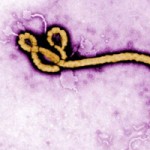 Sức khỏe đời sống - Ebola có lây qua đường tình dục?