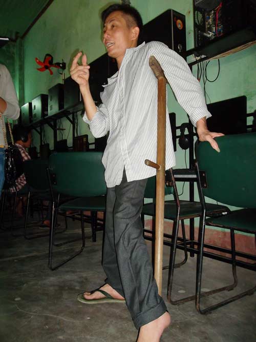 Da cam: Nỗi đau chưa bao giờ dứt - 3