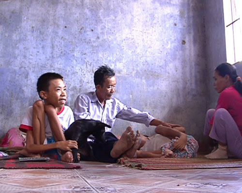 Da cam: Nỗi đau chưa bao giờ dứt - 2