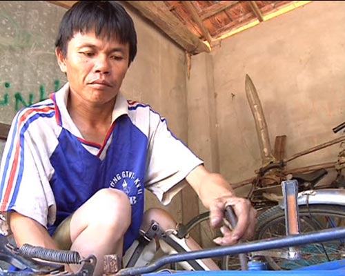 Da cam: Nỗi đau chưa bao giờ dứt - 4