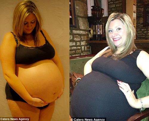 Mẹ bầu có vòng bụng mét rưỡi giảm 30kg trong nửa năm - 1