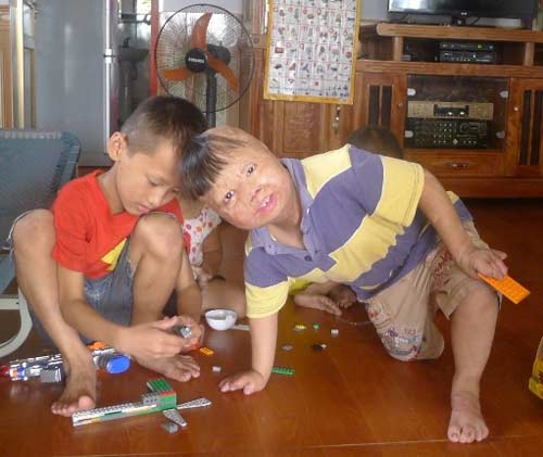 Nghẹn lòng cuộc sống cháu bé bị bố đốt 3 năm trước - 7