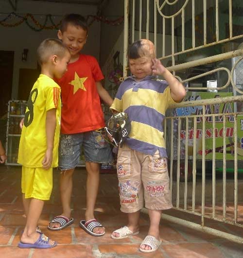 Nghẹn lòng cuộc sống cháu bé bị bố đốt 3 năm trước - 9