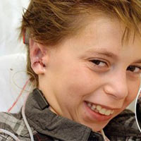 Ghép tai làm từ sụn người cho cậu bé 9 tuổi
