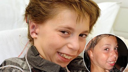 Ghép tai làm từ sụn người cho cậu bé 9 tuổi - 1