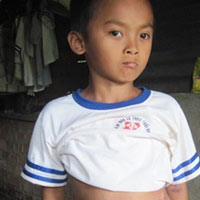 Sức khỏe đời sống - Bé trai nhầm giới tính vì không có hậu môn, bộ phận sinh dục