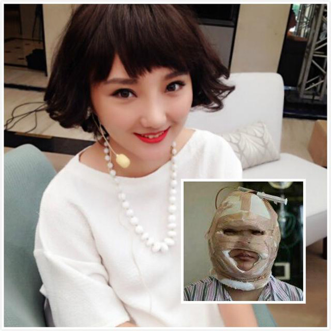 Nữ ca sỹ Vương Tử - cựu thí sinh Super Girls – thay đổi chóng mặt sau khi phẫu thuật tốn hơn 2 tỷ đồng.
