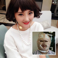 Ca nhạc - MTV - Quá trình “dao kéo” hơn 2 tỷ đồng của nữ ca sỹ TQ