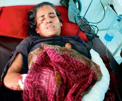 Ấn Độ: Lão bà phản công đánh chết báo hoang - 1