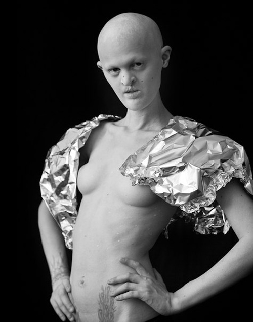 Người mẫu kỳ dị khiến triệu trái tim phải thổn thức - 4