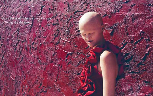 Người mẫu kỳ dị khiến triệu trái tim phải thổn thức - 7