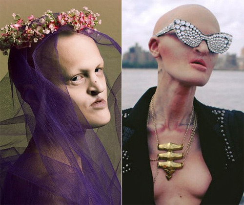 Người mẫu kỳ dị khiến triệu trái tim phải thổn thức - 8