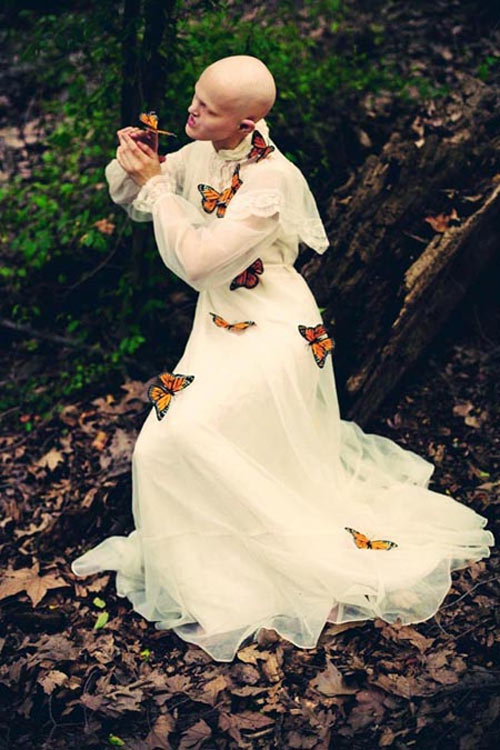 Người mẫu kỳ dị khiến triệu trái tim phải thổn thức - 5