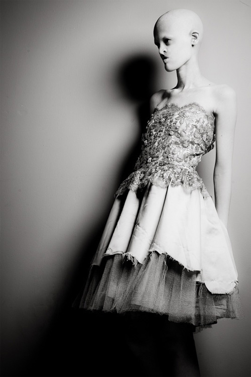 Người mẫu kỳ dị khiến triệu trái tim phải thổn thức - 6