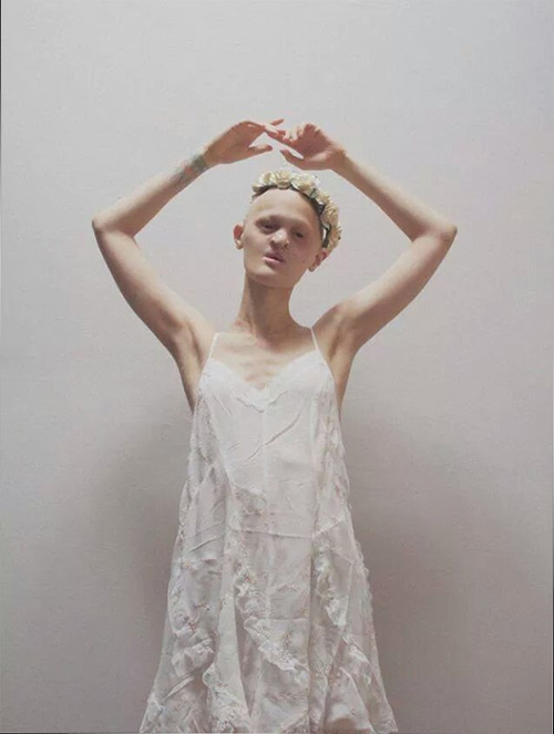 Người mẫu kỳ dị khiến triệu trái tim phải thổn thức - 11