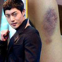 Kim Hyun Joong rời lịch nhập ngũ sau scandal đánh bạn gái