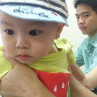 Sức khỏe đời sống - Cứu sống bé 8 tháng bị ngừng tuần hoàn