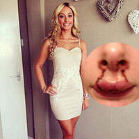 Bạn trẻ - Cuộc sống - Cắn nát môi bạn gái xinh đẹp vì sợ bị phản bội