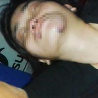 Pháp luật - Bảo vệ khu phố dùng dây siết cổ, đạp vợ ngất xỉu