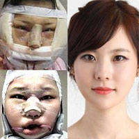 Thẩm mỹ viện - "Ghê răng" trước những cuộc hành xác để làm đẹp