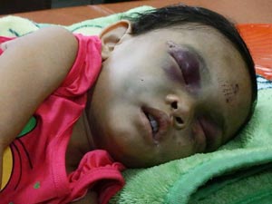 Tin tức trong ngày - Bé gái 4 tuổi bị đánh dã man: Hàng xóm từng quỳ gối xin tha