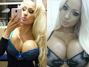 Làm đẹp cùng sao - Bộ ngực to như hai quả bóng bay của người mẫu Úc