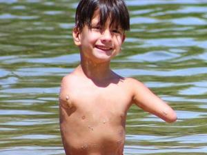 Phi thường - kỳ quặc - Khâm phục nghị lực của bé trai không có chân tay