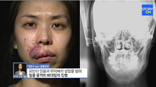Màn lột xác ấn tượng của cô gái có "gương mặt quỷ" - 3