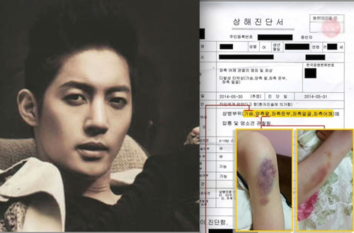 Kim Hyun Joong chưa thoát tội vũ lực với bạn gái - 2