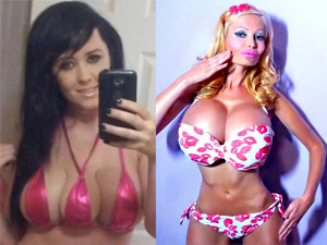 Thẩm mỹ viện - Choáng với 8 ca "dao kéo" kỳ quặc và quái dị