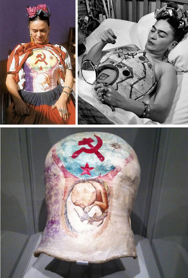 Frida Kahlo vốn là một diễn viên nghệ thuật, tuy nhiên, do cột sống quá yếu nên cô đành phải dùng bó bột phần thân để chữa bệnh. Chính vì thế cô đã tự mình trang trí cho “lớp áo” đó bằng những hình lưỡi liềm, ngôi sao, ông mặt trời và hình một người đang ngồi trong vòng tròn. Đến nay, sau khi khỏi bệnh, lớp áo vẫn được cô giữ lại làm kỷ niệm.
