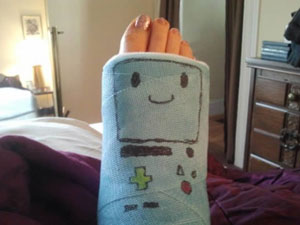 Phi thường - kỳ quặc - 15 mẫu thiết kế đặc biệt dành cho tay – chân bó bột