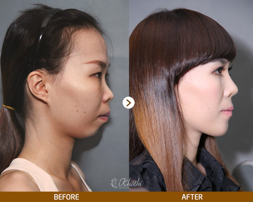 Cơ hội sở hữu gói dịch vụ làm đẹp lên đến 1 tỷ đồng - 4