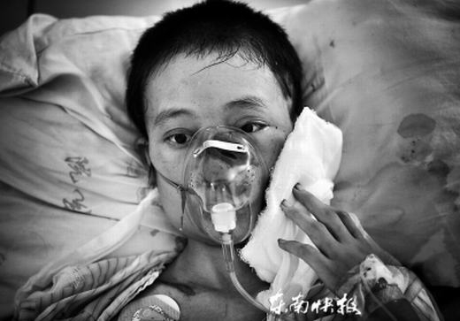 Cô gái xinh đẹp tử vong vì bị hàng trăm con giòi ký sinh - 2