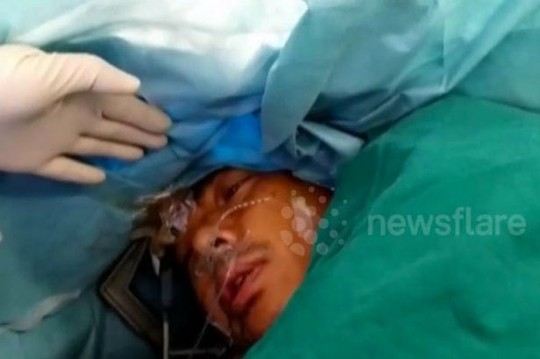 Đang mổ não, bệnh nhân bất ngờ hỏi giá cổ phiếu, đọc thơ - 1