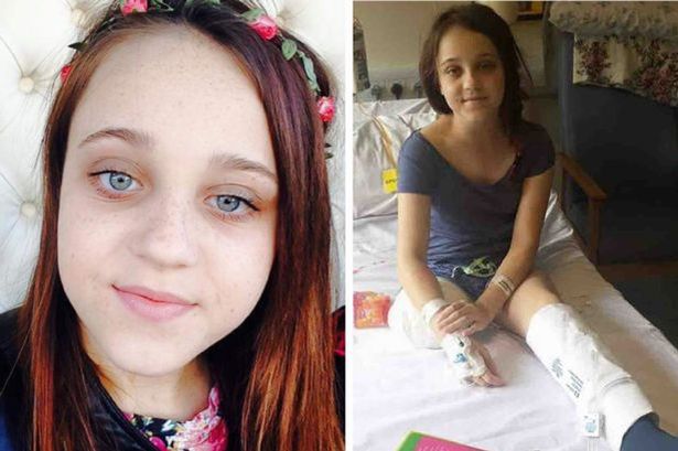 Bé gái 13 tuổi muốn cắt chân vì có quá nhiều khối u - 1