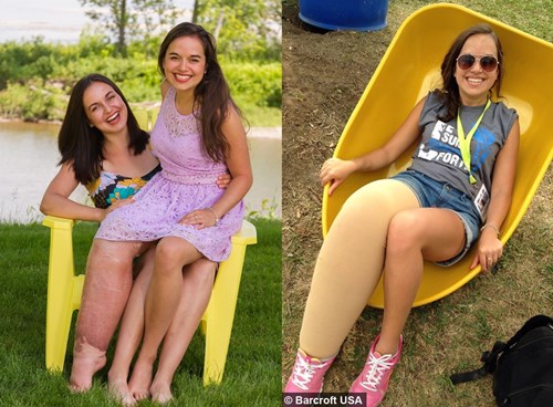 Video: Cô gái có chân phải khổng lồ trở thành hoa hậu - 1